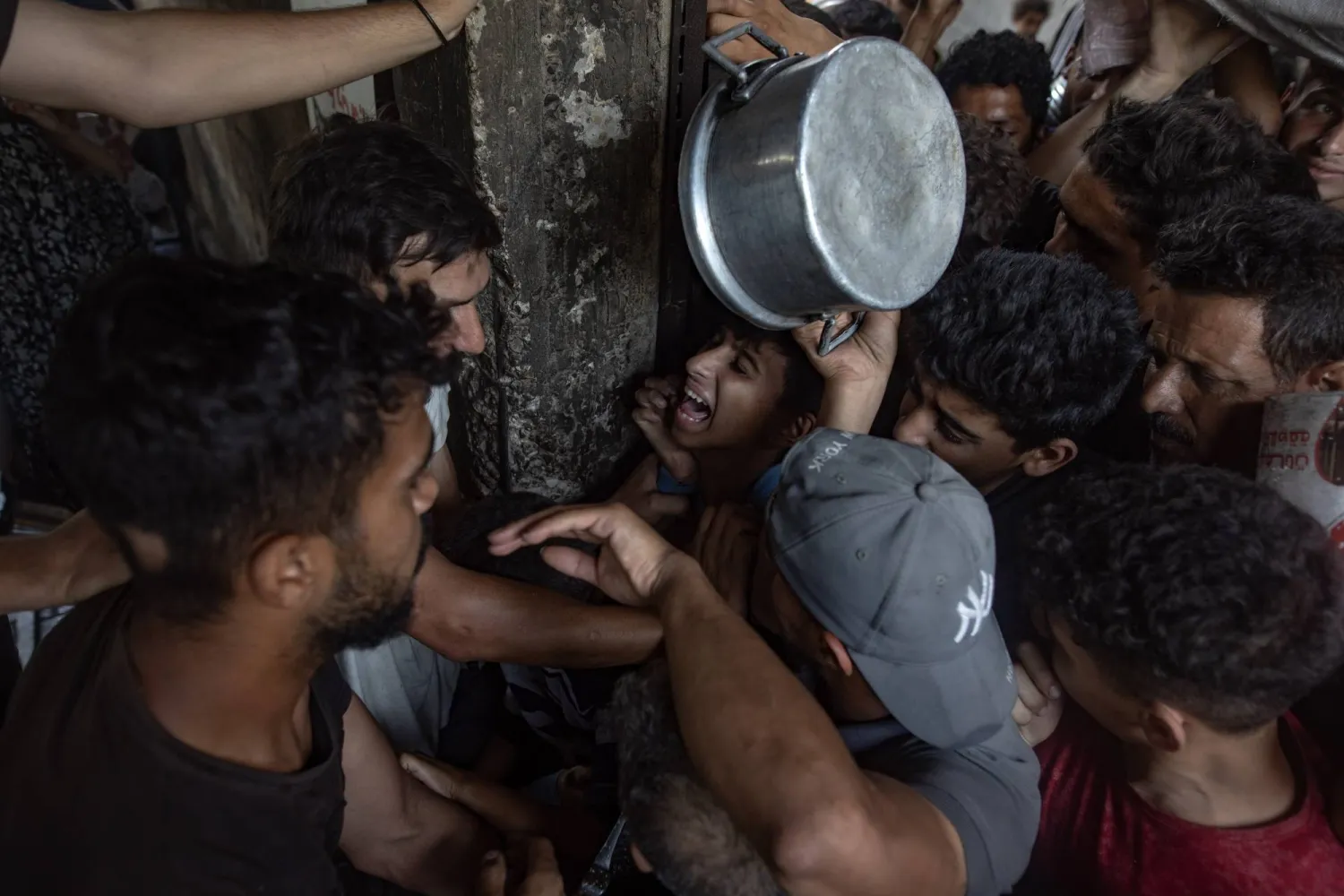 يتضور جوعاً… «الأونروا» تعرض حالة إنسانية لطفل مصاب بالشلل في غزة